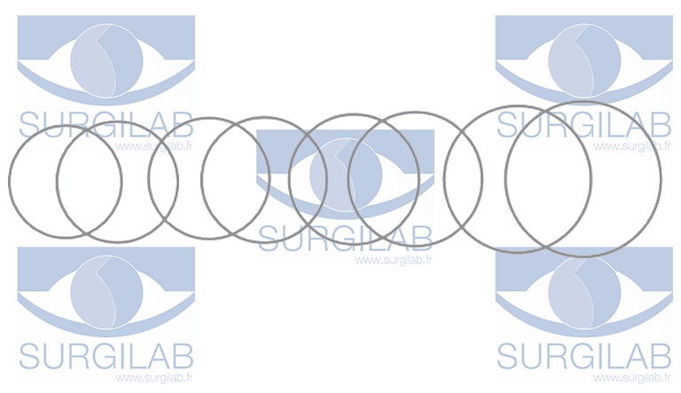 FLIERINGA scleral fixation  ring, set off ( 8 ) size S